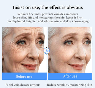 EFERO Hyaluronic Acid Essence Serum Moisturizing Snail Day Cream Face Cream Anti Wrinkle Firming Whitening Brighten Face Cream Alodia Store