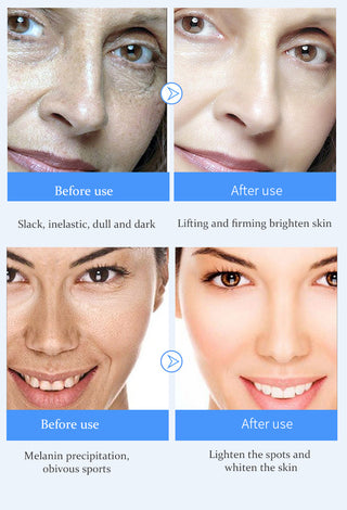 EFERO Hyaluronic Acid Essence Serum Moisturizing Snail Day Cream Face Cream Anti Wrinkle Firming Whitening Brighten Face Cream Alodia Store