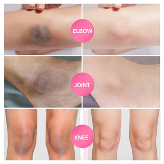 Whitening Cream Armpit Intimate Areas Brightening Underarm Private Parts Body Skin Care Whiten Cream For Dark Skin Beauty Health Alodia Store