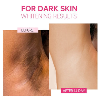 Whitening Cream Armpit Intimate Areas Brightening Underarm Private Parts Body Skin Care Whiten Cream For Dark Skin Beauty Health Alodia Store