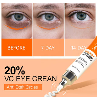 JoyPretty Vitamin C Eye Cream Anti Dark Circles Eye Bag Firmness Moisturizing Whitening Massager Wrinkle Eye Serum Beauty Health Alodia Store
