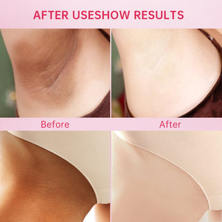 Whitening Cream Armpit Intimate Areas Brightening Underarm Private Parts Body Skin Care Whiten Cream For Dark Skin Beauty Health Alodia Store