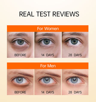 JoyPretty Vitamin C Eye Cream Anti Dark Circles Eye Bag Firmness Moisturizing Whitening Massager Wrinkle Eye Serum Beauty Health Alodia Store