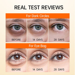 JoyPretty Vitamin C Eye Cream Anti Dark Circles Eye Bag Firmness Moisturizing Whitening Massager Wrinkle Eye Serum Beauty Health Alodia Store