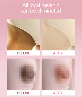 Whitening Cream Armpit Intimate Areas Brightening Underarm Private Parts Body Skin Care Whiten Cream For Dark Skin Beauty Health Alodia Store