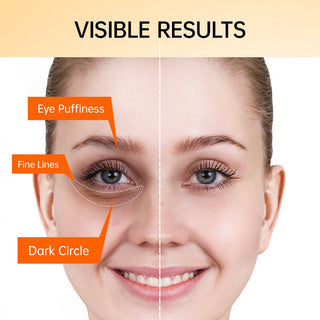 JoyPretty Vitamin C Eye Cream Anti Dark Circles Eye Bag Firmness Moisturizing Whitening Massager Wrinkle Eye Serum Beauty Health Alodia Store