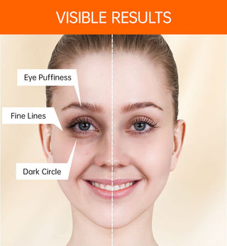 JoyPretty Vitamin C Eye Cream Anti Dark Circles Eye Bag Firmness Moisturizing Whitening Massager Wrinkle Eye Serum Beauty Health Alodia Store