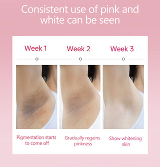 Whitening Cream Armpit Intimate Areas Brightening Underarm Private Parts Body Skin Care Whiten Cream For Dark Skin Beauty Health Alodia Store