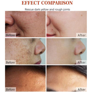 Korean Natural Vegan Neck Facial Vitamin C Acne Pimples Dark Spot Remover ALODIA STORE