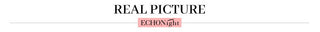 Echonight Sexy Women's Underwear Transparent Lingerie Embroidery Wireless Bra and Panty Set with Thongs Blue Lace Erotic Sets ALODIA STORE