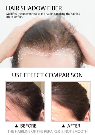 Sevich 12g Hair Line powder ALODIA STORE