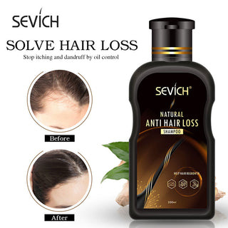 Sevich 10 pcs/lot Instant Black Hair Shampoo Make Grey and White Hair Darkening Shinny in 5 minutes ALODIA STORE