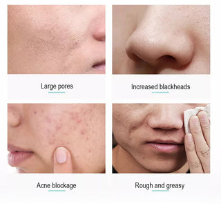 Matcha Exfoliating Face Scrub Moisturizing Oil Control Peeling Mud Mask Remove Dead Horny Blackhead Anti Acne Body Scrub ALODIA STORE