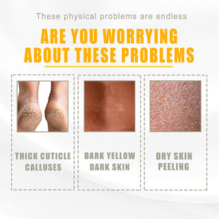 Exfoliation Yellow Peeling Oil Foot Leg Remove Dead Skin Deep Cleansing Remove Dark Whitening Body Skin Care ALODIA STORE