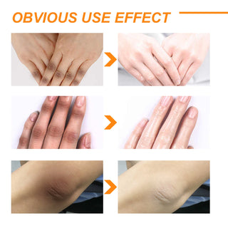 Insantly Whitening Peeling Gel Lotion Exfoliating Mask Fnger Knee Armpit Dark Skin Body Moisturizing Brighten Scrub Cream Care ALODIA STORE