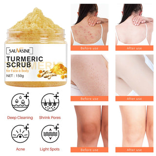 Turmeric Body Scrub Skin Brightening Face Scrub For Dark Spots Body Care Supplies Scrubs Cream For Waist Legs Thighs ALODIA STORE