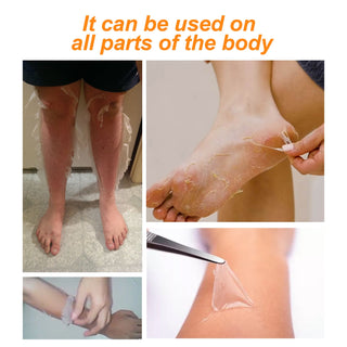 Insantly Whitening Peeling Gel Lotion Exfoliating Mask Fnger Knee Armpit Dark Skin Body Moisturizing Brighten Scrub Cream Care ALODIA STORE