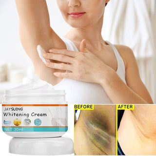 For Women Men Underarm Whitening Cream Armpit Knee Dark Dullness Skin Intimate Area Bleaching Cream Moisturizing Brighten Lotion ALODIA STORE