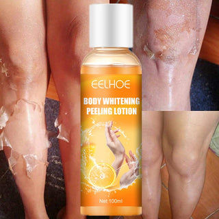 Insantly Whitening Peeling Gel Lotion Exfoliating Mask Fnger Knee Armpit Dark Skin Body Moisturizing Brighten Scrub Cream Care ALODIA STORE
