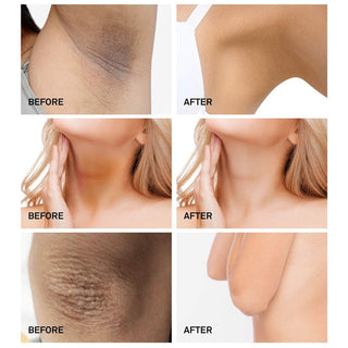 For Women Men Underarm Whitening Cream Armpit Knee Dark Dullness Skin Intimate Area Bleaching Cream Moisturizing Brighten Lotion ALODIA STORE