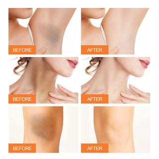 For Women Men Underarm Whitening Cream Armpit Knee Dark Dullness Skin Intimate Area Bleaching Cream Moisturizing Brighten Lotion ALODIA STORE