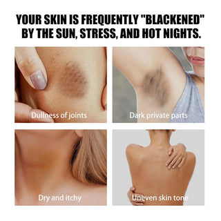 For Women Men Underarm Whitening Cream Armpit Knee Dark Dullness Skin Intimate Area Bleaching Cream Moisturizing Brighten Lotion ALODIA STORE