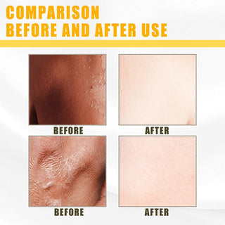 Exfoliation Yellow Peeling Oil Foot Leg Remove Dead Skin Deep Cleansing Remove Dark Whitening Body Skin Care ALODIA STORE
