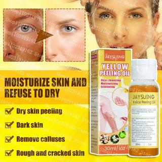 30ml Yellow Peeling Oil Strong Exfoliating Solution Bleaching Dark Skin Spots Blackheads for Body Face Skin Care Beauty