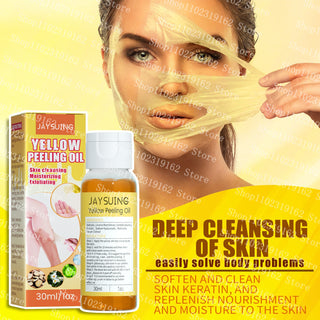 30ml Yellow Peeling Oil Strong Exfoliating Solution Bleaching Dark Skin Spots Blackheads for Body Face Skin Care Beauty